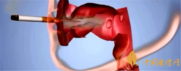 吸煙與肺癌的關系研究 與吸煙關系最為密切的肺癌是鱗癌